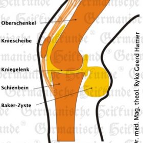 Organ Knorpel – Symptome nach der Germanischen Heilkunde