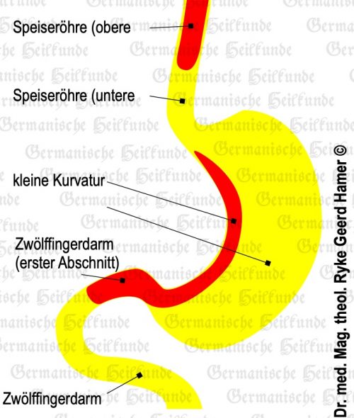 SpeiseröhrenCa (Ösophagus) Akademie für Germanische Heilkunde