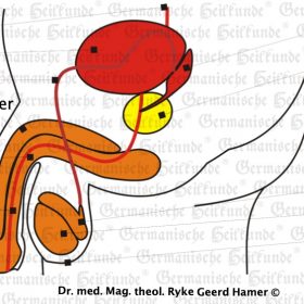 Organ Prostata – Symptome nach der Germanischen Heilkunde
