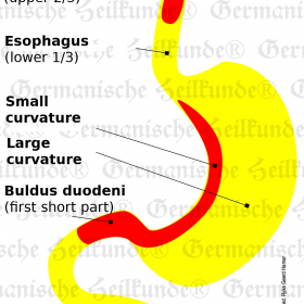 Organ Esophagus - Symptoms according to Germanische Heilkunde®